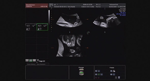 Application Tips & Tricks: Rendering Volume Data