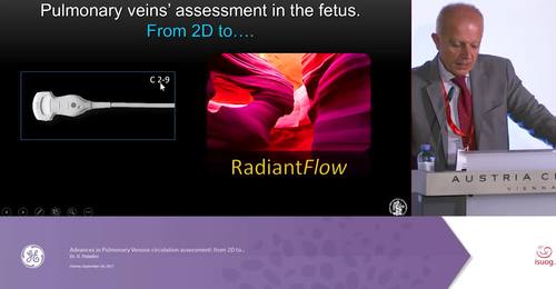 ISUOG 2017 - Advances in Pulmonary Venous Assessment - Dr. D Paladini 