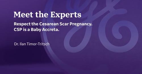 ISUOG 2021- The Connection Between CSP and Placenta Accreta Spectrum. (Dr. Timor Tritch)