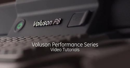 Voluson Performance Series - 3D Gynecology