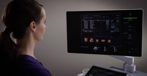 Voluson Expert series - Archive Anonymization - education video