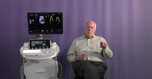 Voluson Fetal Heart  - Why fetalHQ is valuable for Twin to Twin Transfusion Syndrome with Dr. DeVore