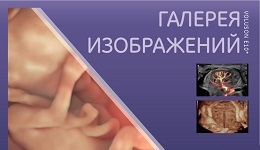 Галерея изображений Ультразвуковая система Voluson E10 BT19 ...