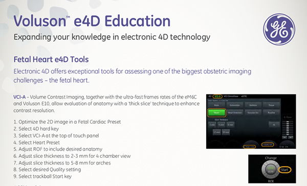 Voluson e4D Fetal Heart QuickCard (BT17)